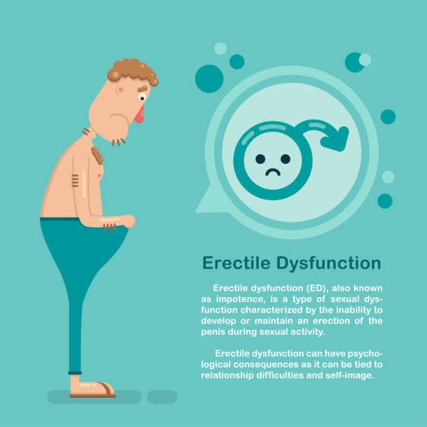 Erectile dysfunction Symptoms causes and treatment.